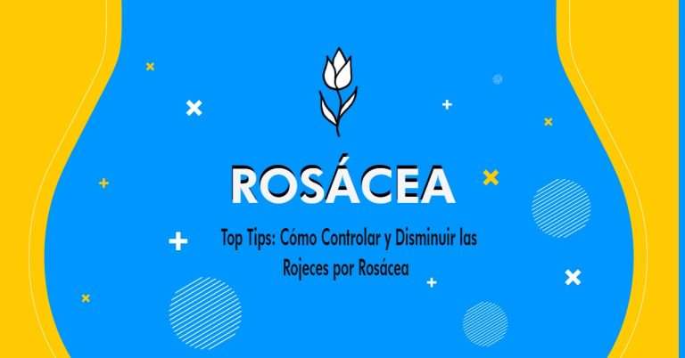 Rosácea: tips y consejos para mejorar en enrojecimiento en el rostro