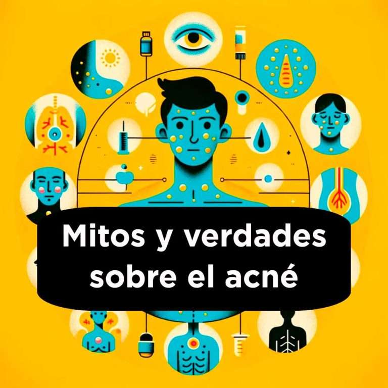 Mitos y verdades sobre el acné