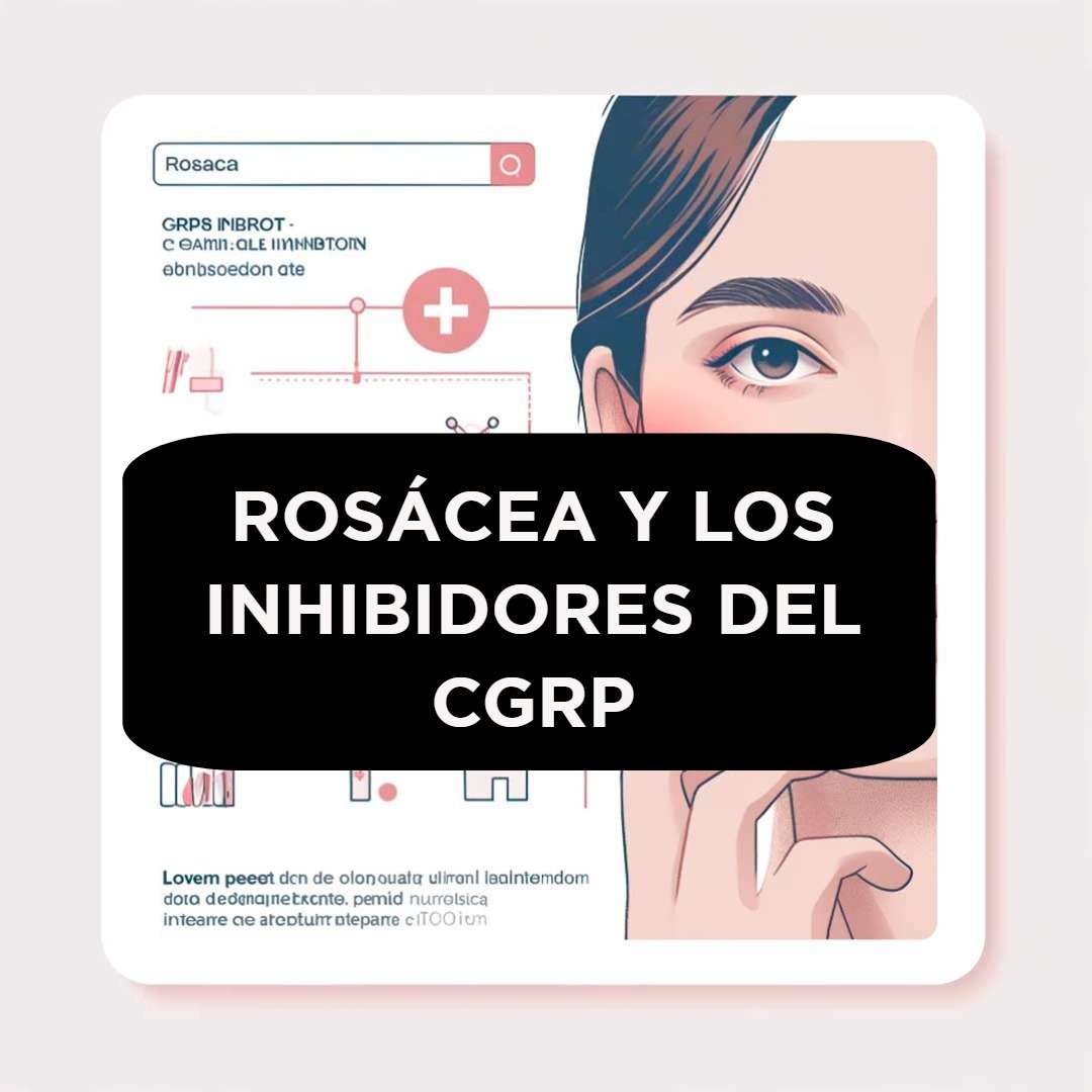 Noticia para la Rosácea en Bucaramanga